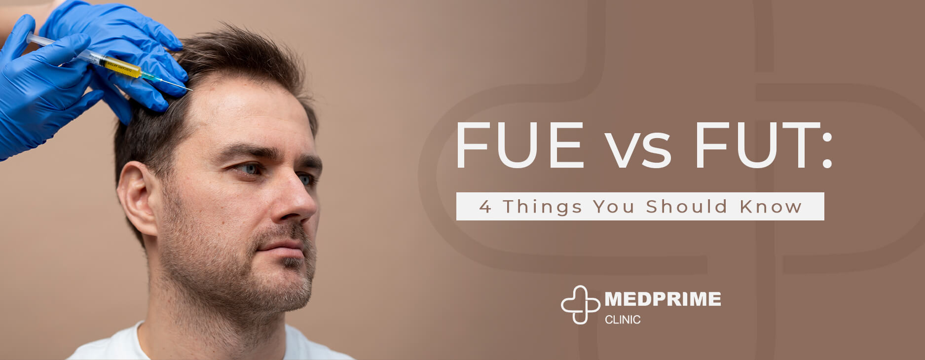 FUE vs FUT: 4 Things You Should Know 